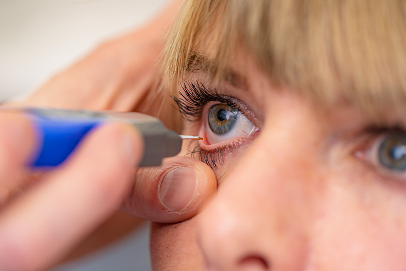 Bestimmung der Tränenfilm-Osmolarität: Augenoptiker hält ein Stäbchen an den Tränenfilm.